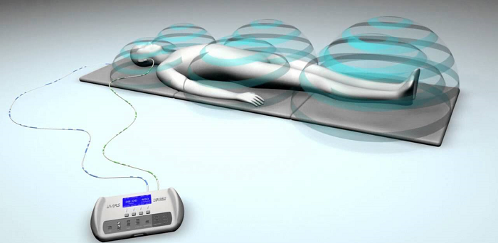 Pulsed Electromagnetic Field Therapy Pemf Therapy Nj Sports Medicine Clinic